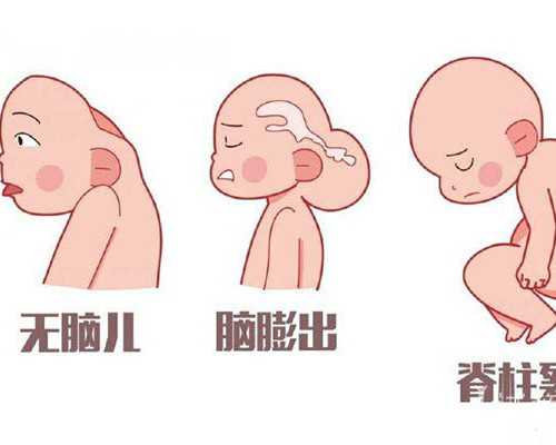 国内哪里能做代孕,试管婴儿可以做吗？试管婴儿*率多高？